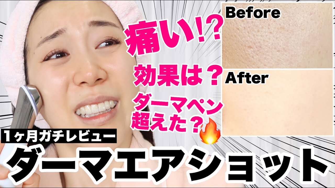韓国美顔器】ダーマエアショットのガチレビュー🔥毛穴が小さくなる
