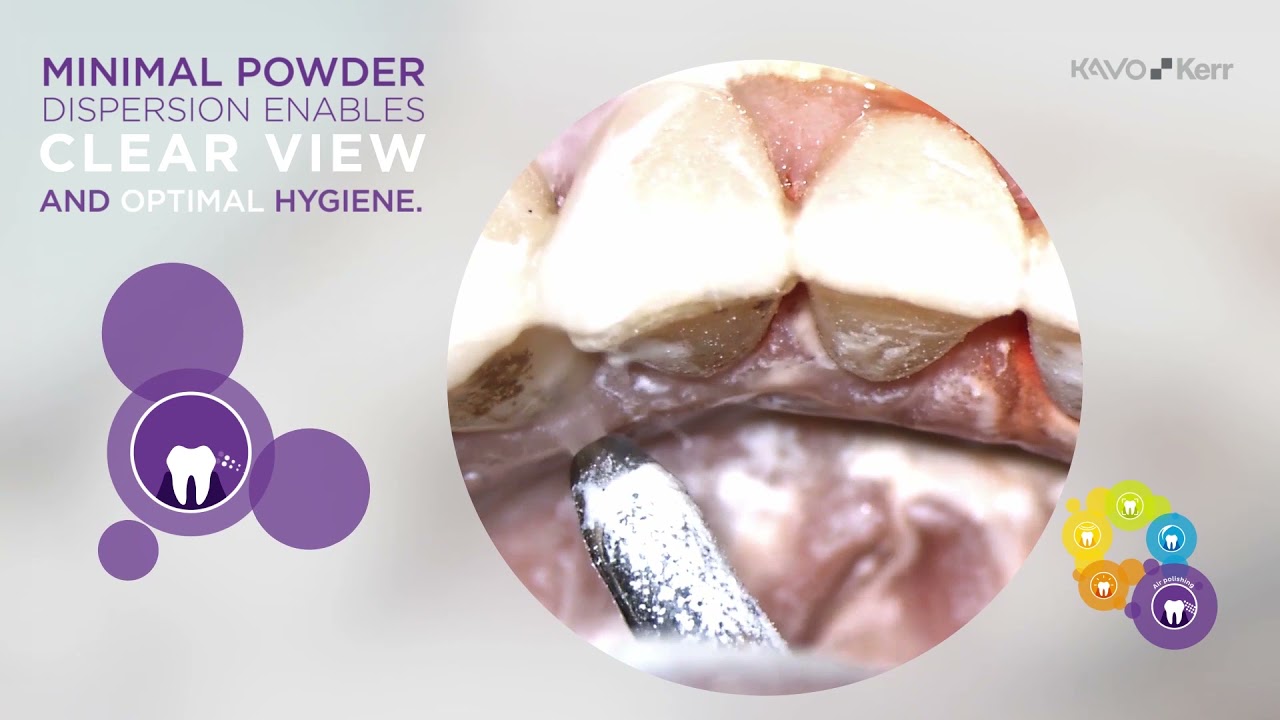 プロフィーフレックス4 | カボ プランメカ ジャパン株式会社 / KaVo