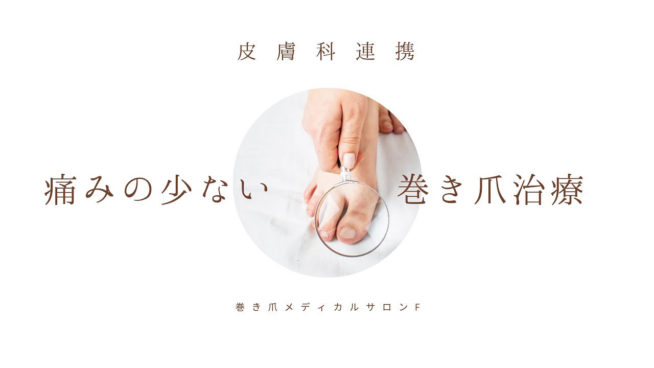 痛くない巻き爪治療 ペディグラスの紹介