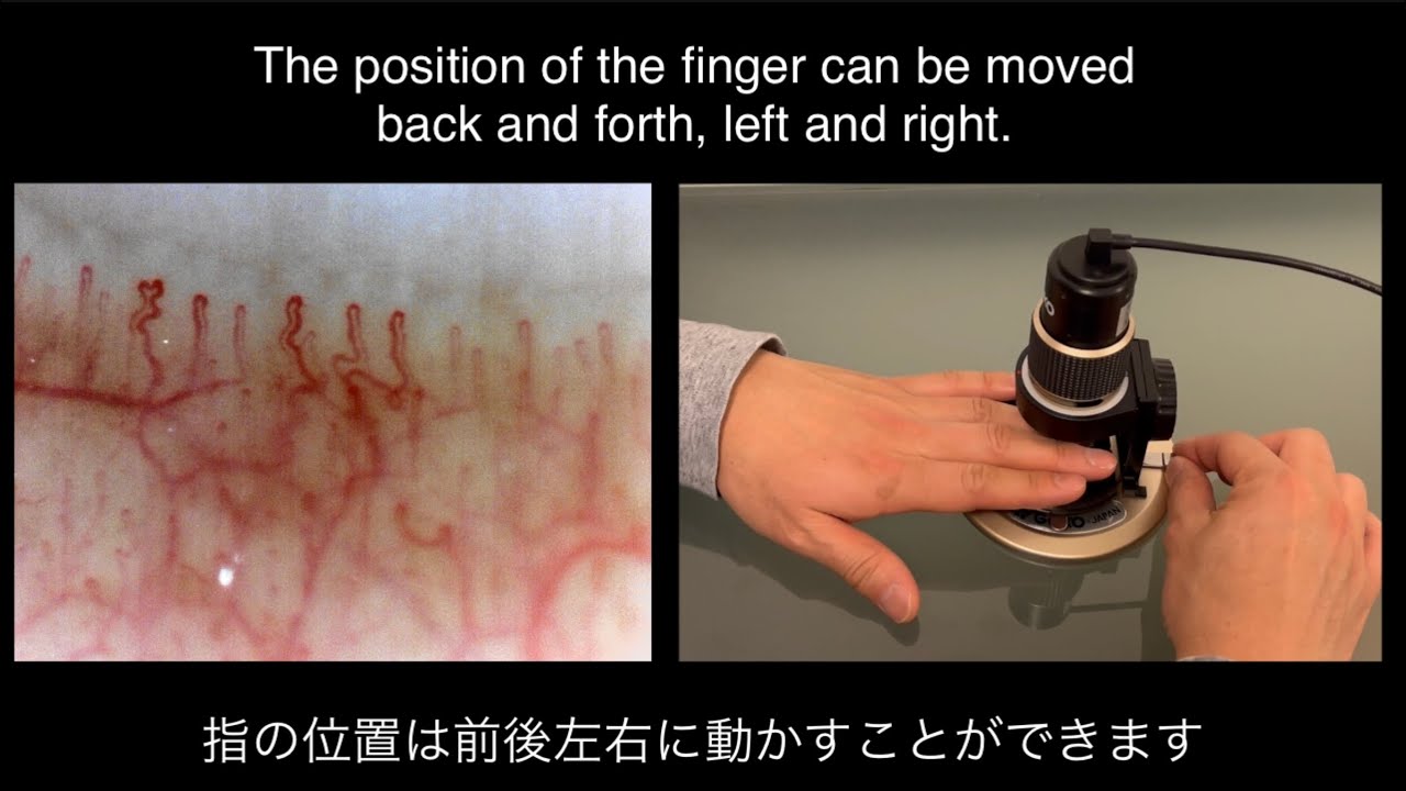 GOKO Bscan ZD｜高精細・毛細血管（血流）スコープ