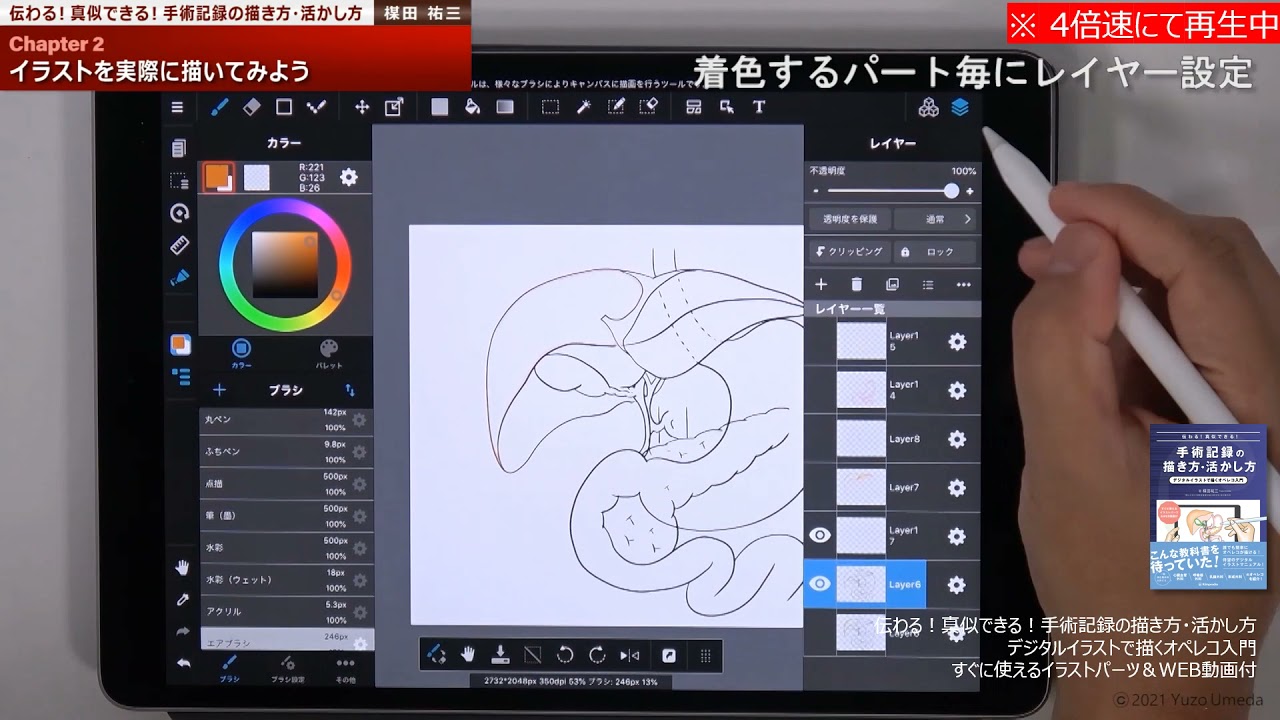 伝わる！真似できる！手術記録の描き方・活かし方 デジタルイラストで