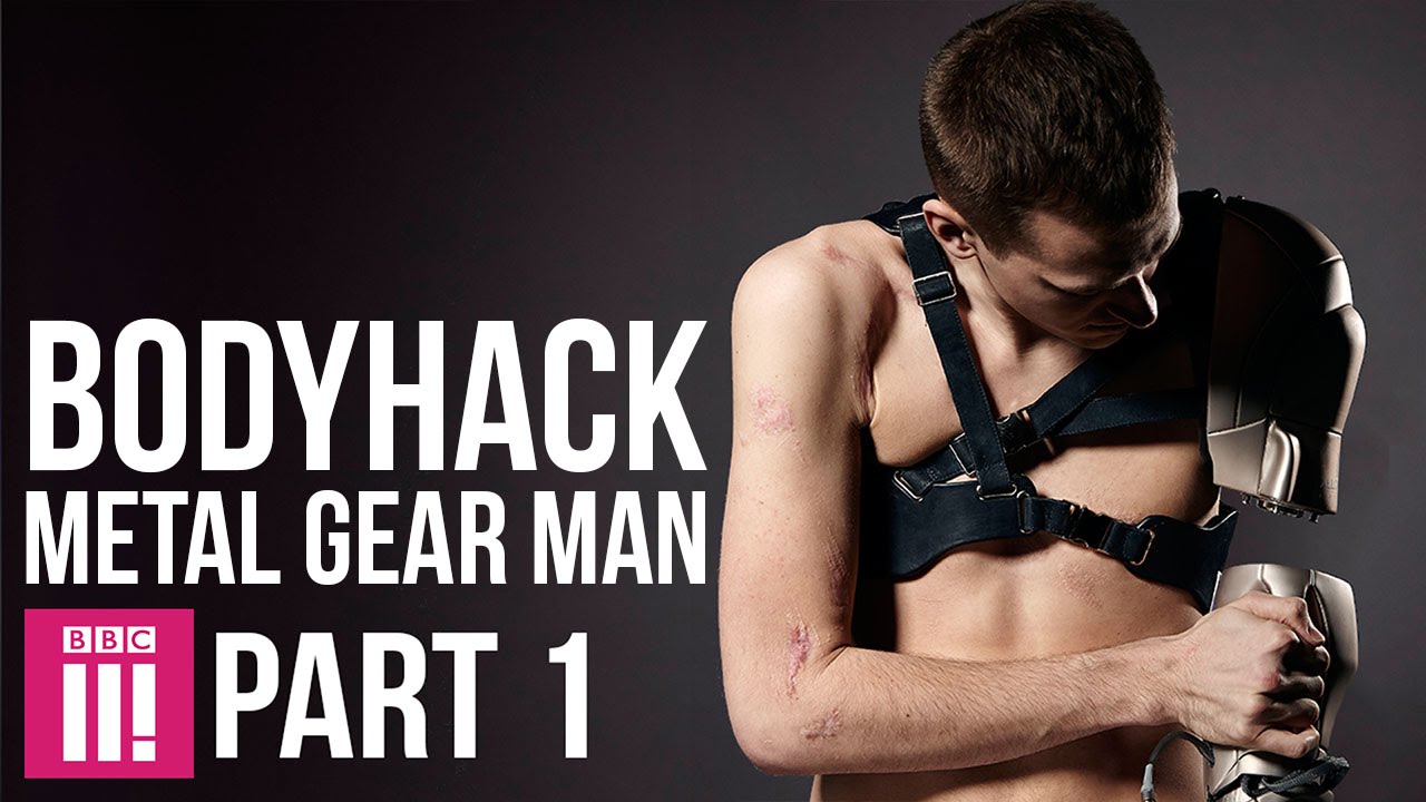 MGSVTPP』のバイオニックアームにインスパイアされた義手開発