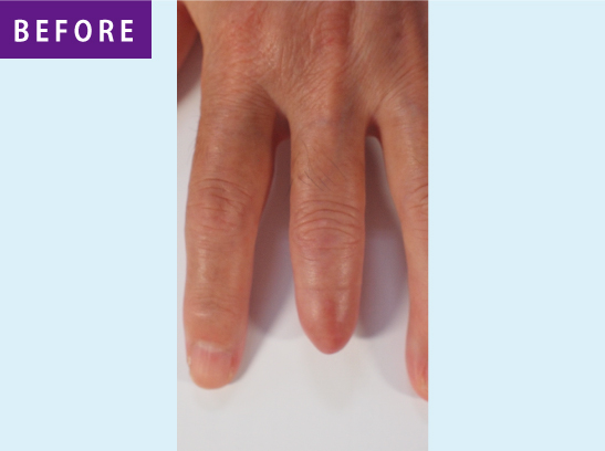 エピテーゼをお考えの方 – 池山メディカルジャパン