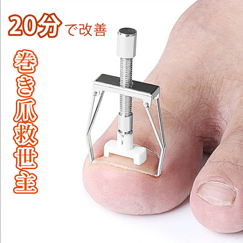 楽天市場】巻き爪 矯正 セット サポート 器具 【20分だけ改善