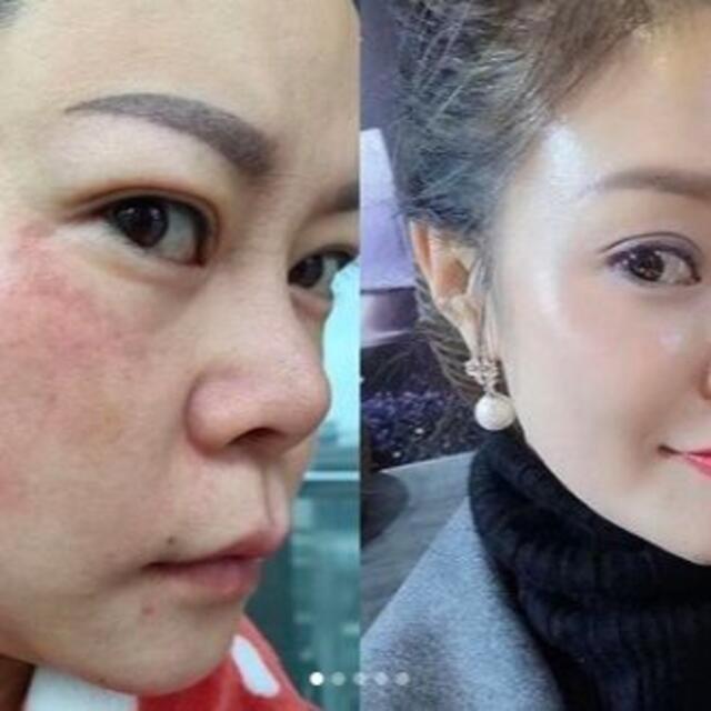 b.glen - ☆正規品☆ルネセル ReneCell ダイヤモンドピール 水光肌