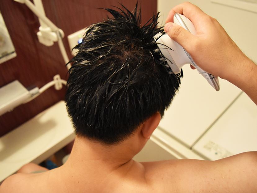音波頭皮ブラシ」VS「頭皮エステ」！ 男の頭皮がスッキリするのは