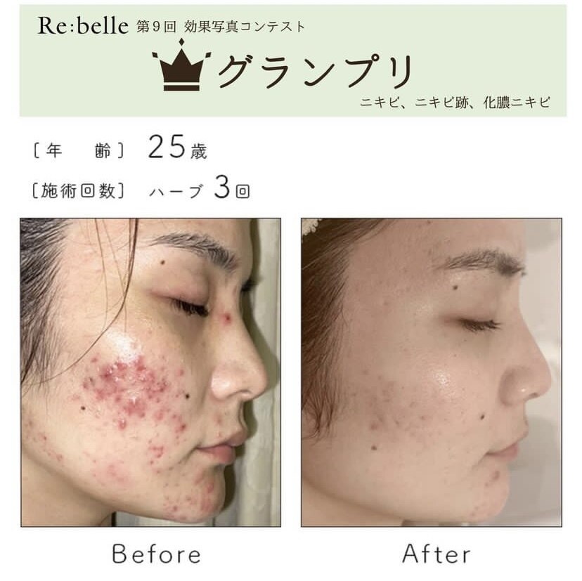 リエイド(Re AID)｜ホットペッパービューティー