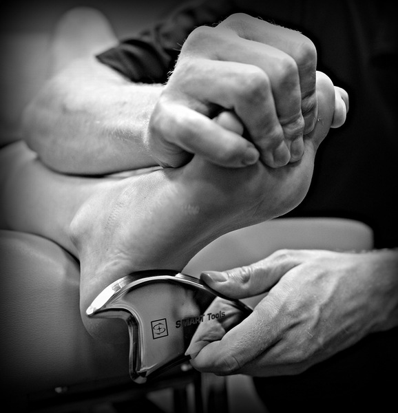 IASTM筋膜リリース(グラストンテクニック)SMART TOOLS