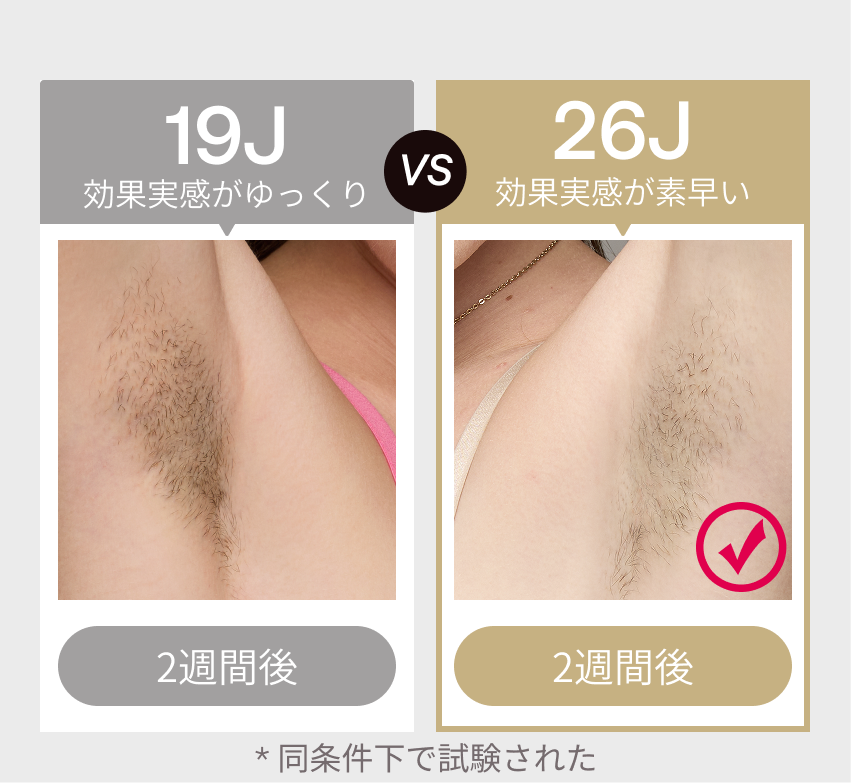 公式】Ulike（ユーライク）脱毛器・ 光美容器のサファイア冷感技術