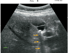 臨床検査技師国家試験第62回 ( 2016年 ) | 臨床検査技師国家試験ウラ解答