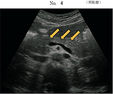 第66回 ( 2020年 ) 解説 PM21～PM40 | 臨床検査技師国家試験ウラ解答