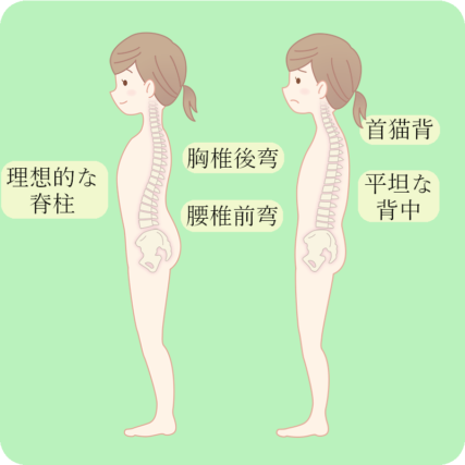 側弯症のための運動療法（シュロス法）を行っています | 滋賀県守山市