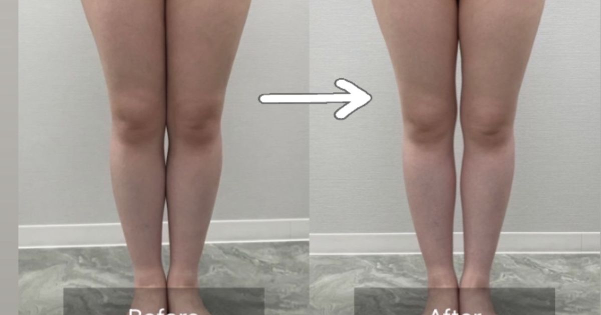 リアボーテ 大阪】エキスパートスタイルウェア 効果