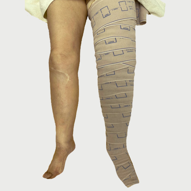 THUASEN Mobiderm - チュアンヌ モビダーム | 弾性着衣 | 株式会社リンパ