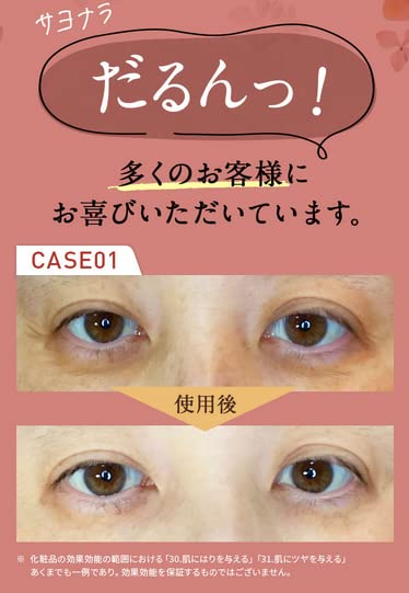 Amazon.co.jp: 17skin アイニードルクリーム 10g（約1ヶ月分