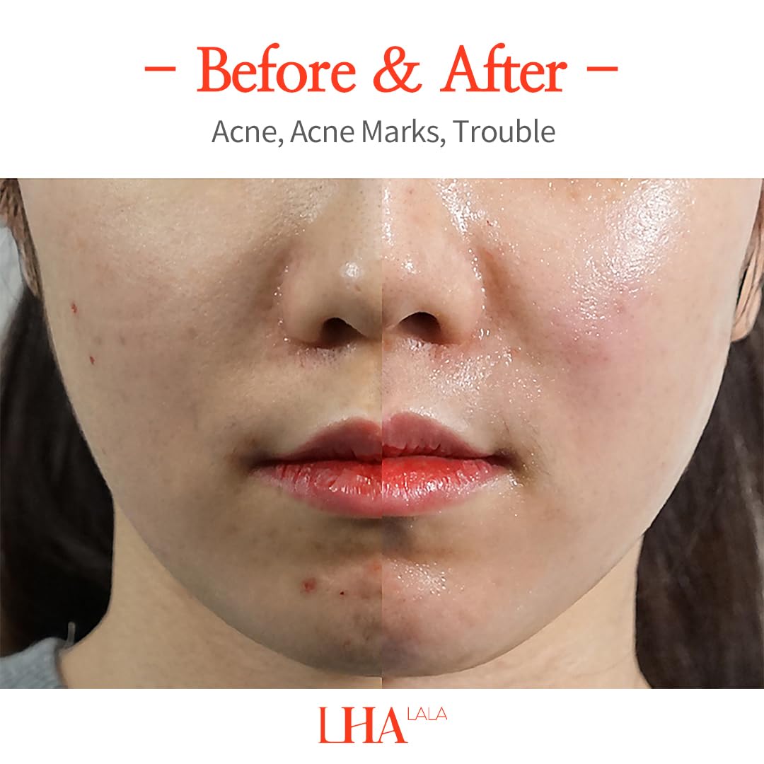 Amazon.co.jp: LHA LALA Peel Set Basic & Ultra ララ ピール