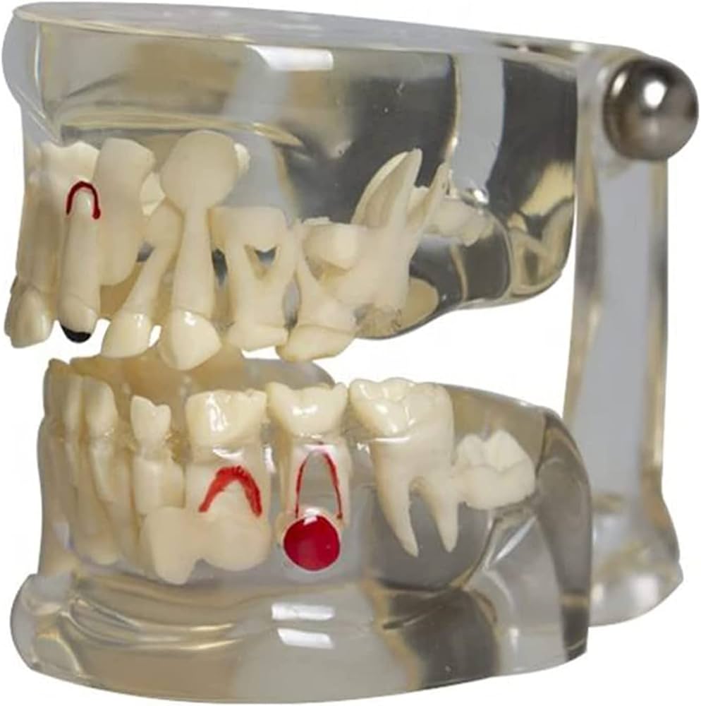 Amazon.co.jp: 歯列模型 子供の乳歯モデル子供の透明歯のモデル 乳歯と
