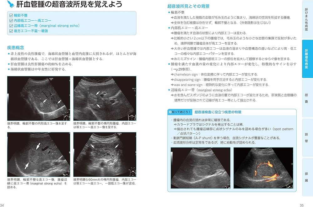超音波検査士認定試験対策:臨床編 消化器領域・健診領域 Book 1