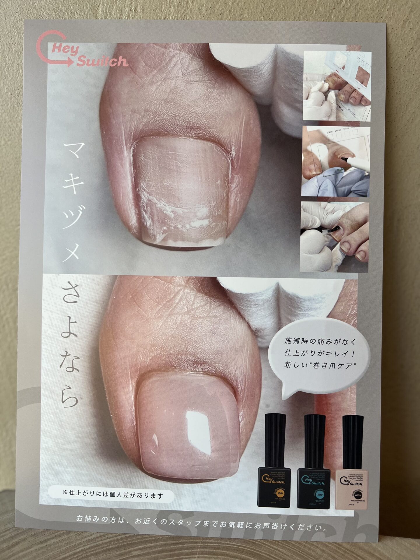 巻き爪ケア ～Hey Switch～ – Nail Doux（ネイルドゥ）