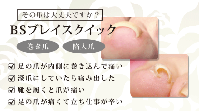 BSブレイスクイックとは？｜仙台のネイルサロン『NAIL MAJIC(ネイル