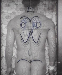 モアレトポグラフィー | 仙台で腰痛、ぎっくり腰、筋肉疲労の治療なら