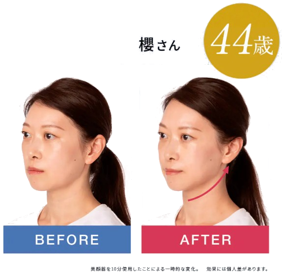 ブライト エレキブラシ+ プーさんデザイン美顔器の口コミ解析！リフト