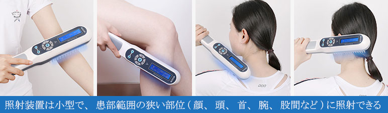 家庭用ナローバンドUVB光線治療器（UVB蛍光管1本搭載） – 家庭用
