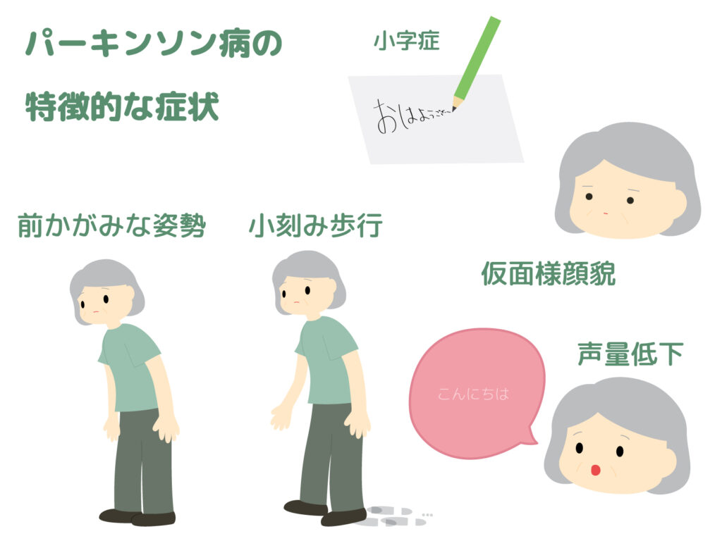 パーキンソン病の姿勢反射障害はなぜおきる？ | 東京/渋谷/脳卒中と