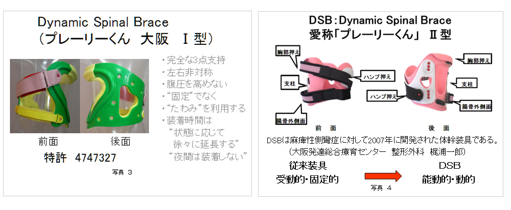 医療に従事する方へ | 医療用装具側弯矯正装具プレーリーくん | 社会