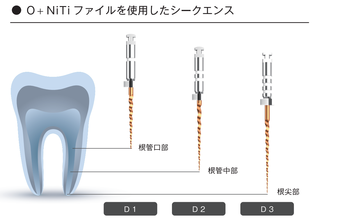 プレミアムプラスジャパン｜Premium Plus Japan｜O+NiTi ファイル-根管治療
