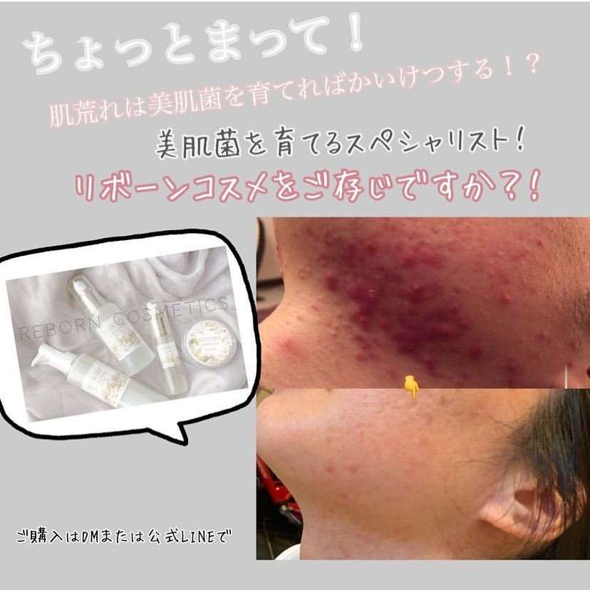 Re:BORN ヴィセルクリーム プレミア 30g (2個） リボーンプレミアムクリーム 30g<br>¥9,350（税込） | 商品紹介