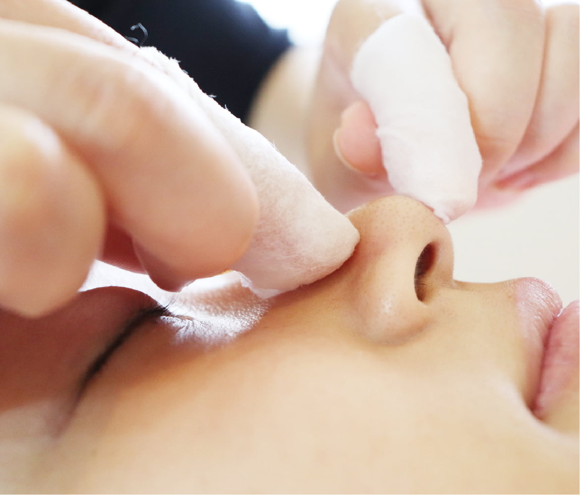 毛穴エクストラクション - 凜メディカルクリニック