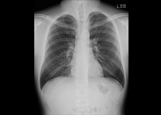 一般撮影｜中央放射線部｜独立行政法人 国立病院機構 災害医療センター