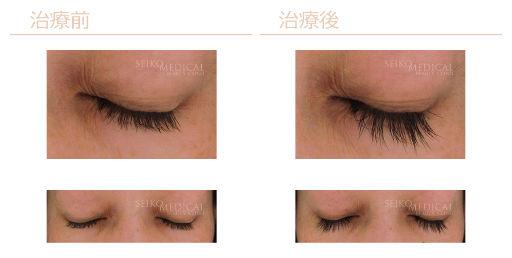 グラッシュビスタ | セイコメディカルビューティクリニック｜鹿児島｜福岡