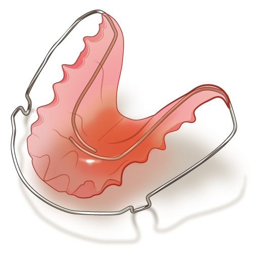 リテーナーの重要性】矯正治療は装置が外れたら終わり？【大宮駅2分