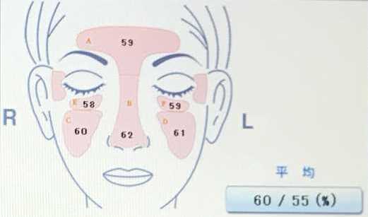 フェイシャル前に肌診断機クレオでお肌の状態を確認｜川崎でスキンケア