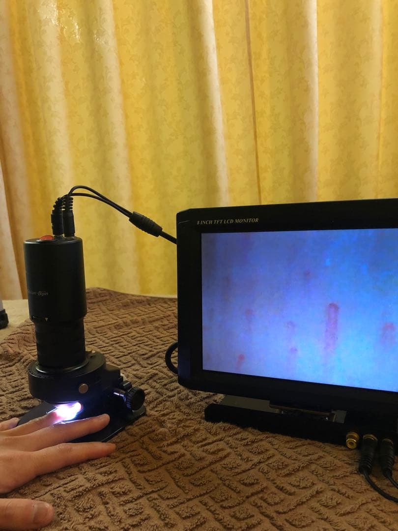 血管美人　マーキュレーター