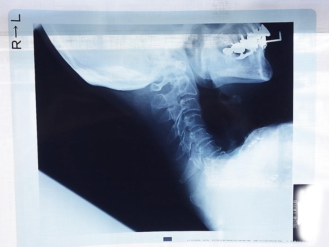 レントゲン写真　X線写真　　Z97 Vol.6］X線って何？ ｜ レントゲン写真の仕組み - 医療法人 横浜平成会