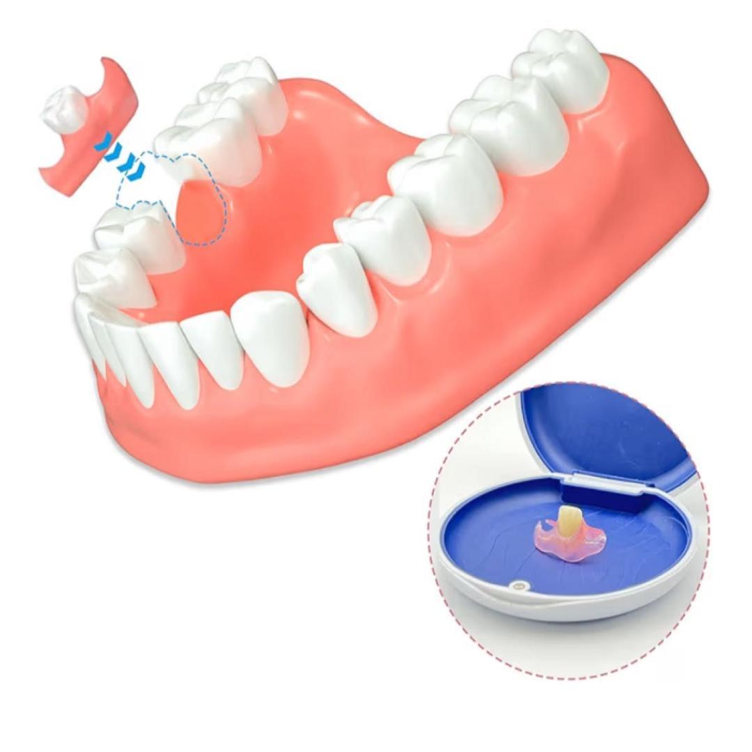 セルフフィッティング 仮歯 歯型採取キット付 カスタマイズ 1本 欠損