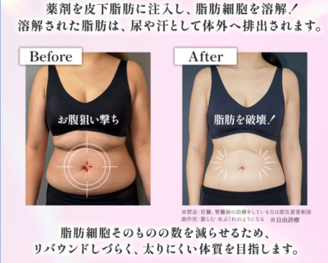 即ヤセ!! 激痩せ!!皮下脂肪溶解 カベリン!!残り1セットのみ☆5ボトルセット