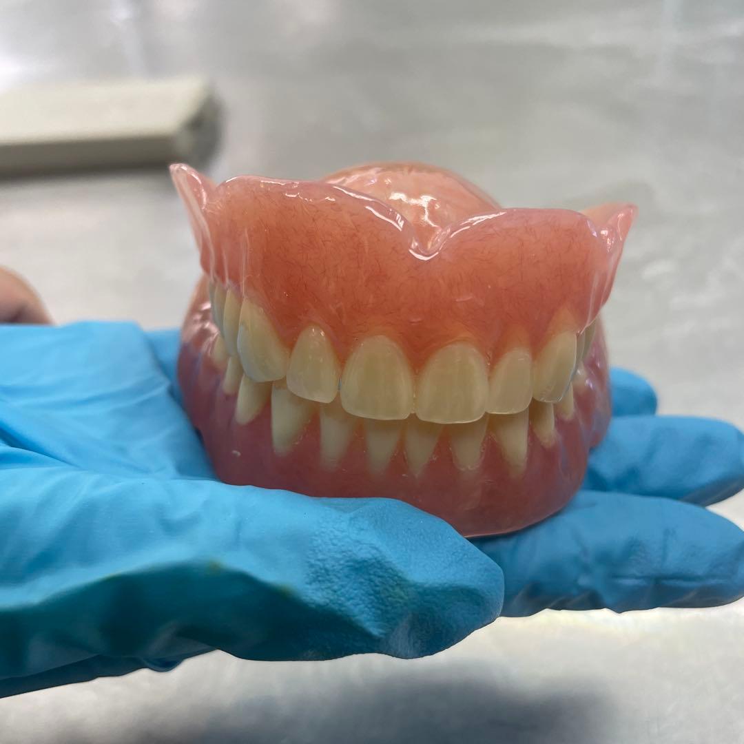 義歯　見本　総義歯 入れ歯 全部床義歯 歯科 ばんばんざい義歯