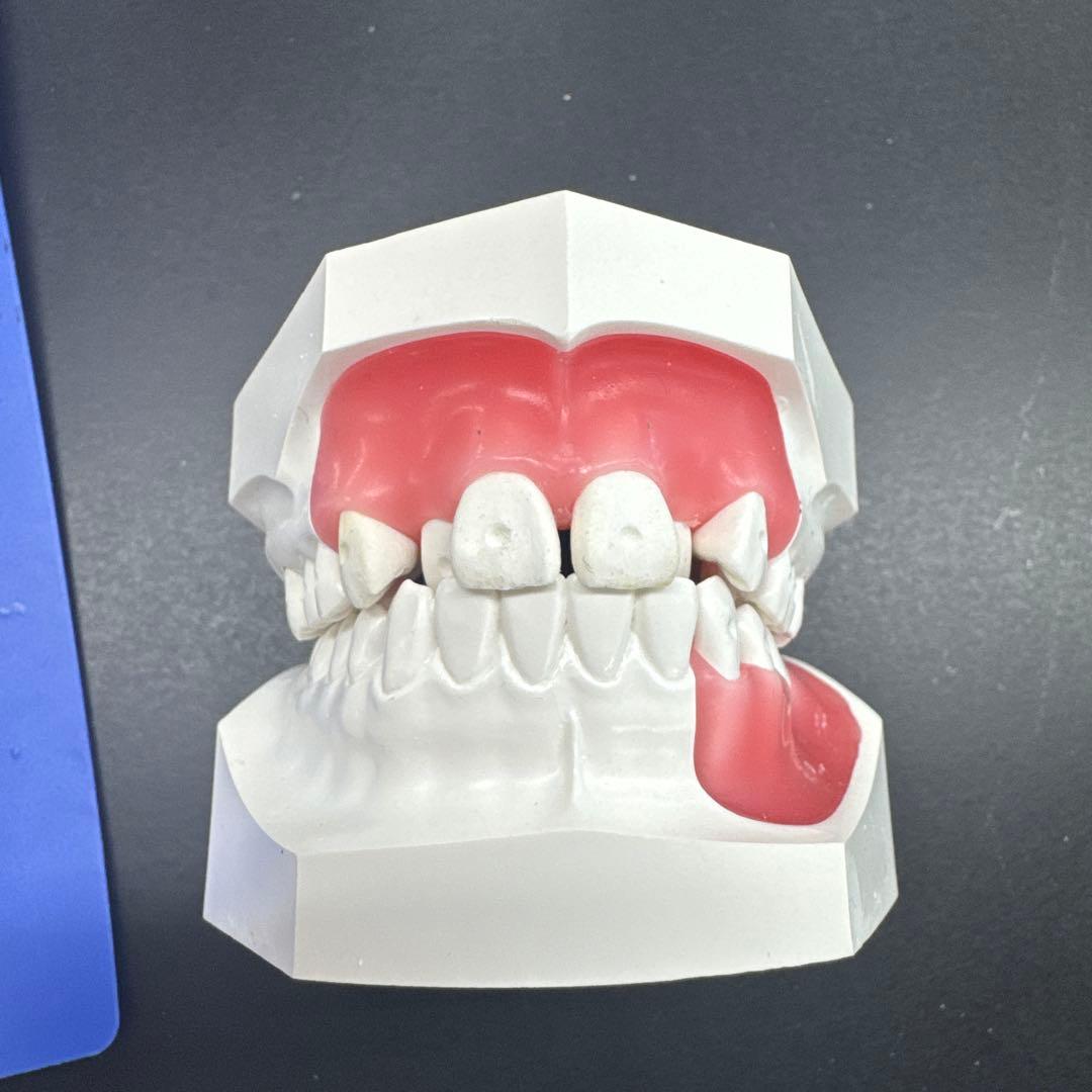 タイポドント模型　未使用