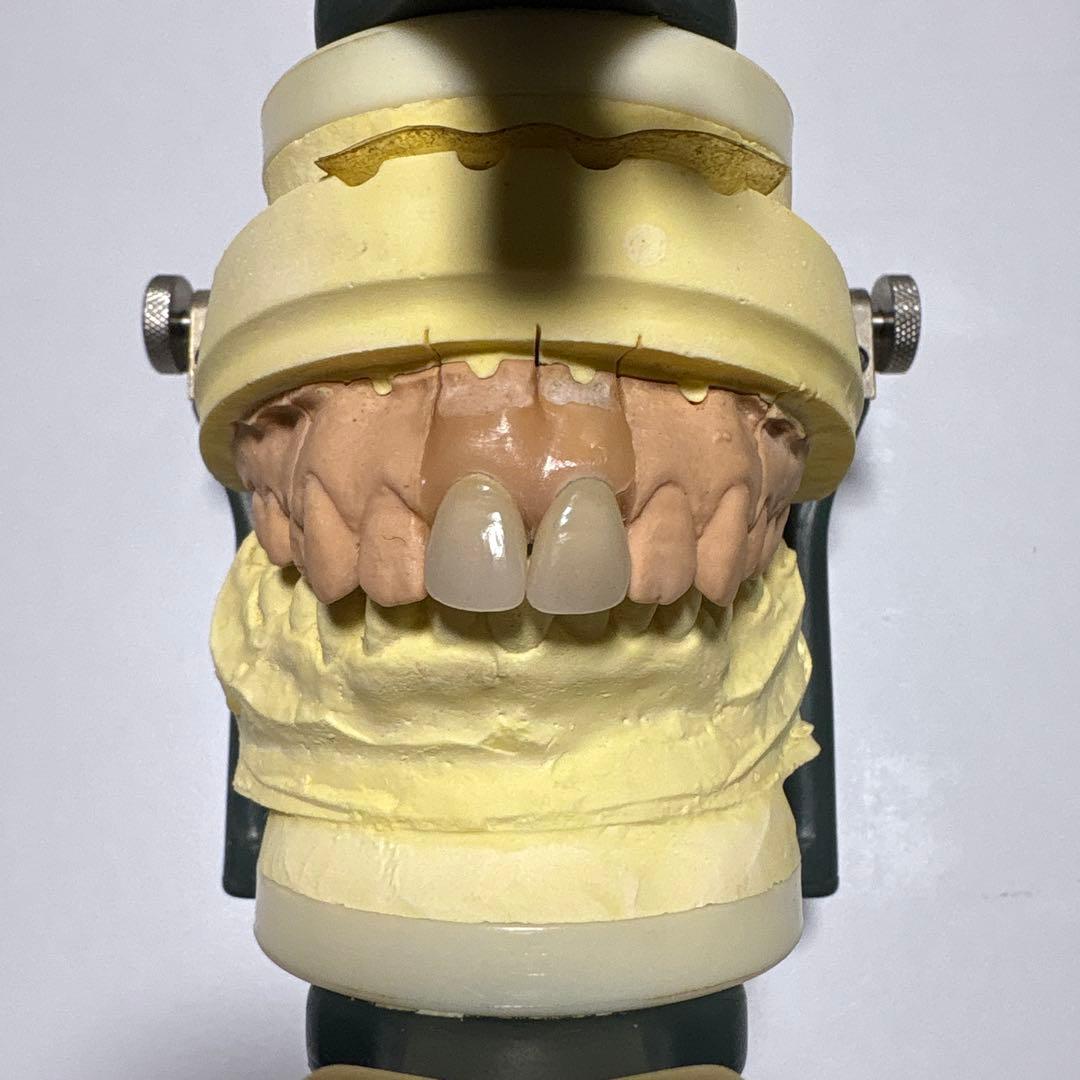 LABOMATE II 咬合器付きメタルボンド