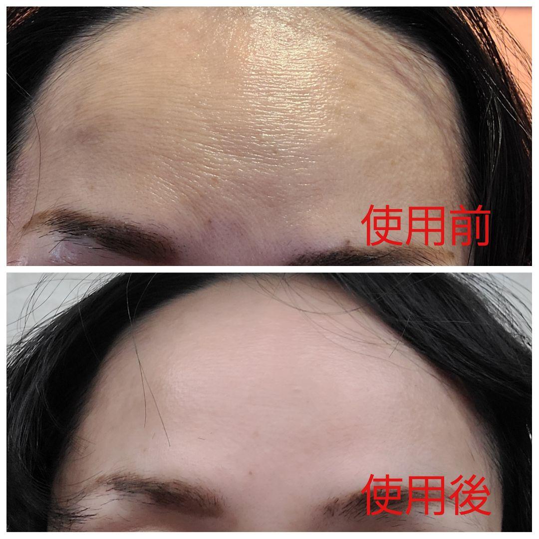 ヴィジョン・ド・ボーテ12個セット　高濃度シワとりクリーム塗るボトックス