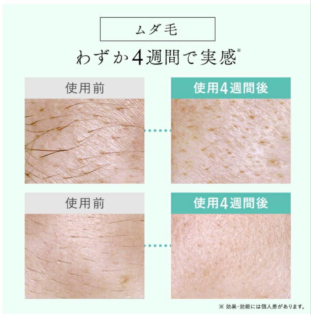 新品未開封 ステラボーテ IPL&LED光美容器 脱毛器 美顔器 リファ