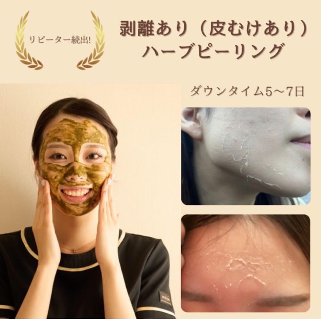 T.R Savings 剥離ありハーブピーリング10回分