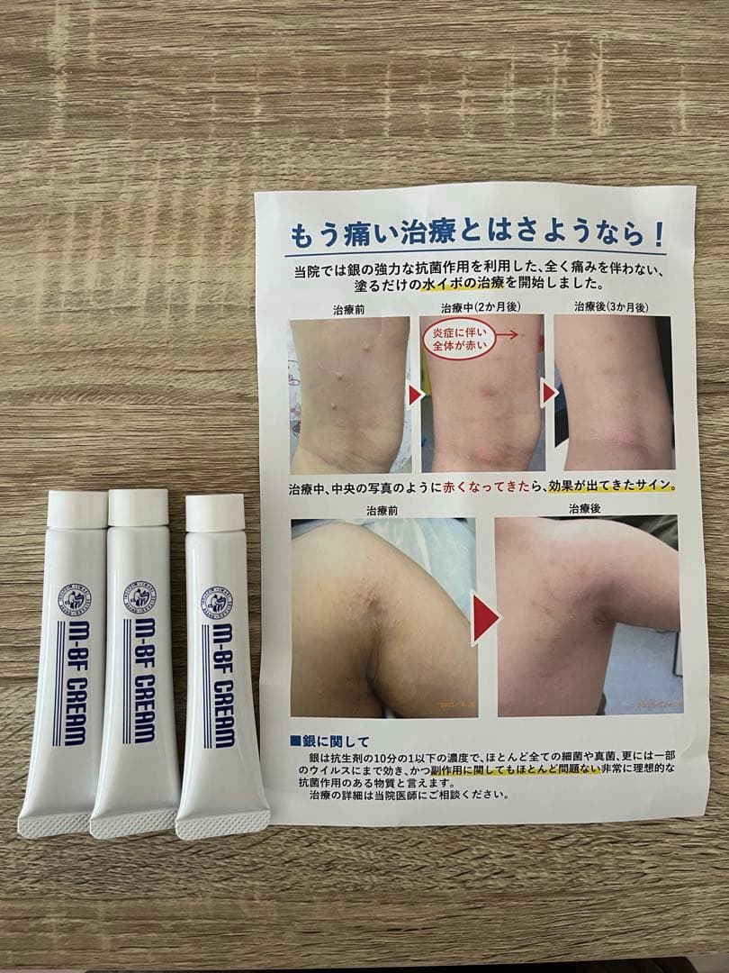 【未開封】m-BF-CREAM 3本セット　エムビーエフクリーム　水イボ