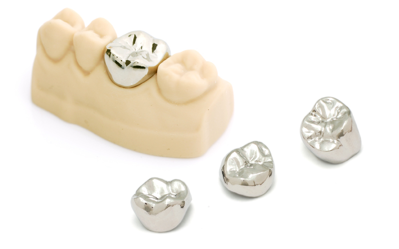 保険鋳造チタンクラウン-株式会社須山歯研